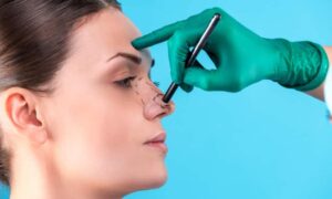 Read more about the article Badly done rhinoplasty: when cosmetic surgery does not go as expected